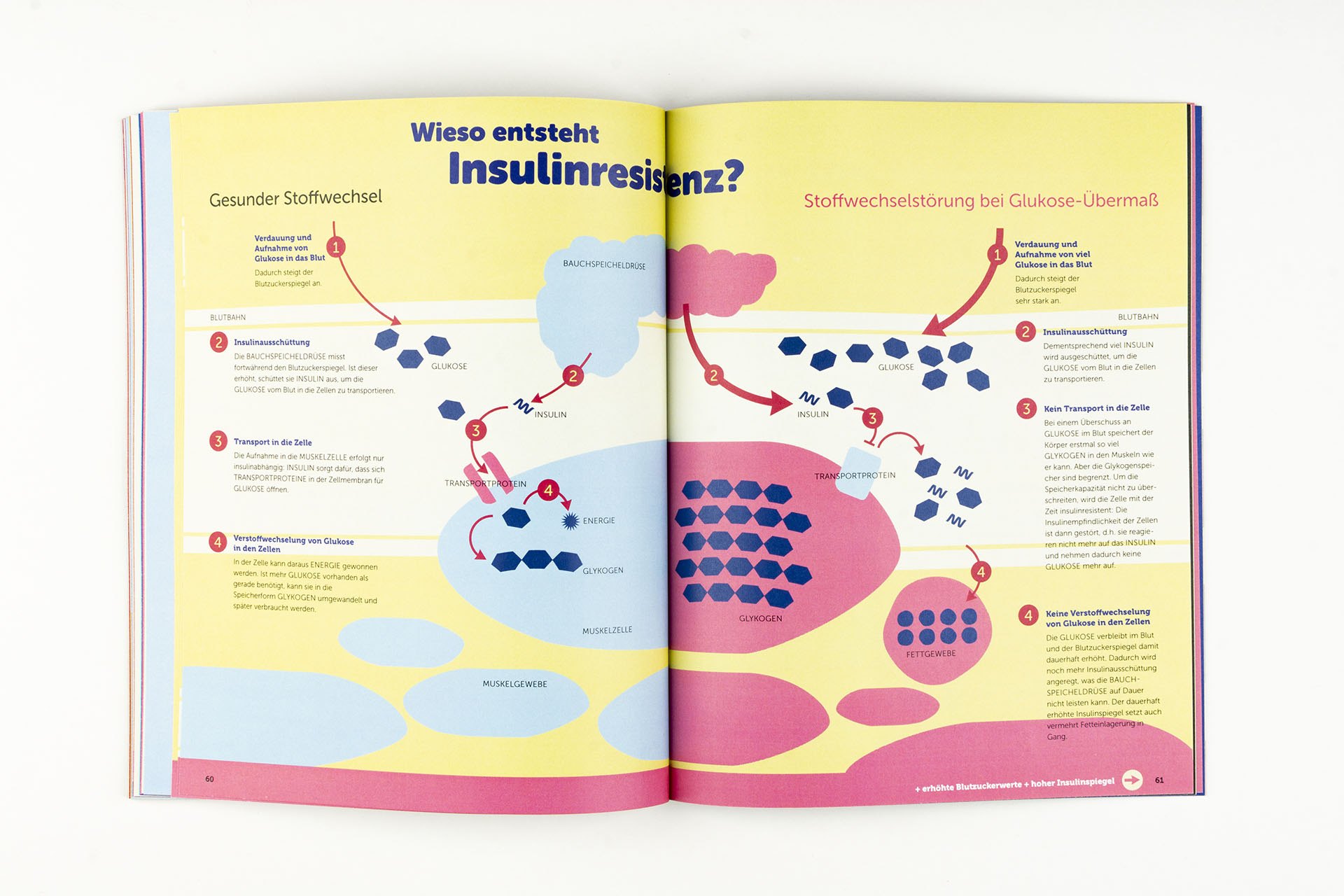 Wie entsteht Insulinresistenz Prozessgrafik
